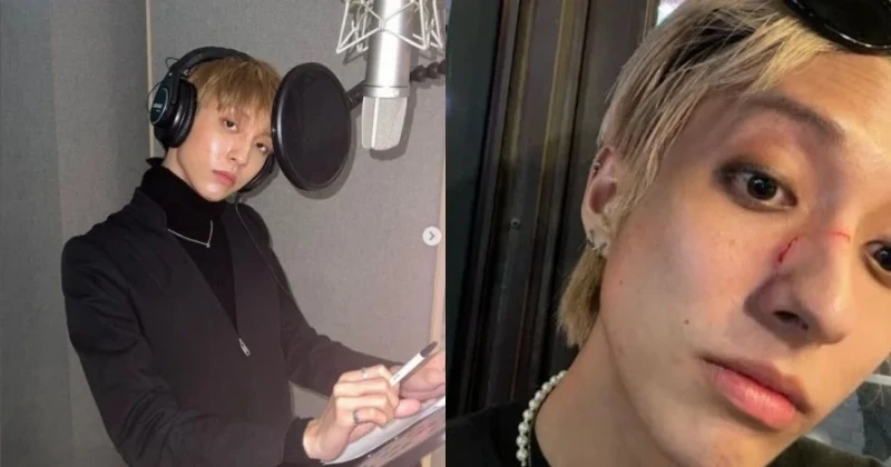 韓國偶像勇敢出櫃卻遭路人痛毆　悲憤曬血照：被罵髒Gay