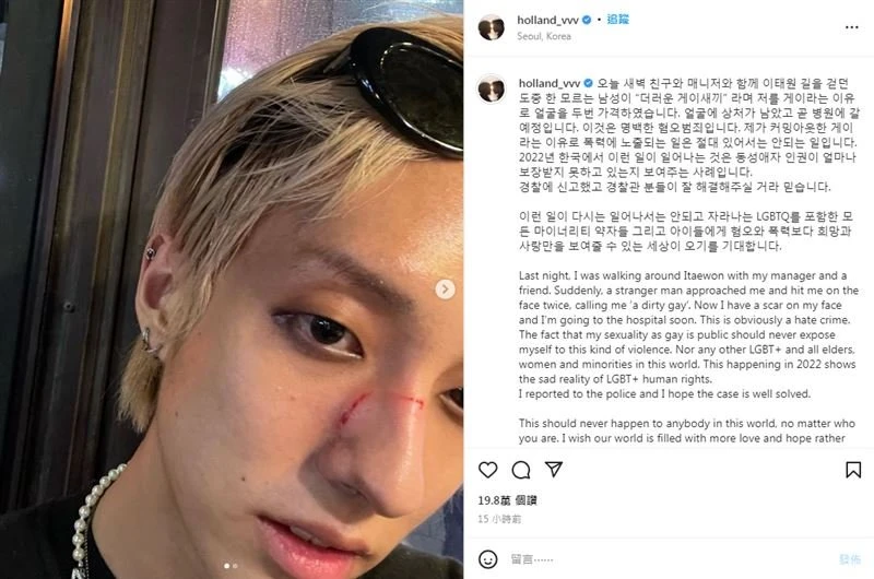 韓國偶像勇敢出櫃卻遭路人痛毆　悲憤曬血照：被罵髒Gay