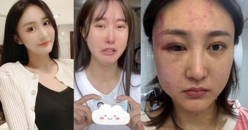 半年遭老公家暴4次   知名網紅痛哭曝瀕死過程