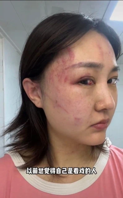 半年遭老公家暴4次   知名網紅痛哭曝瀕死過程