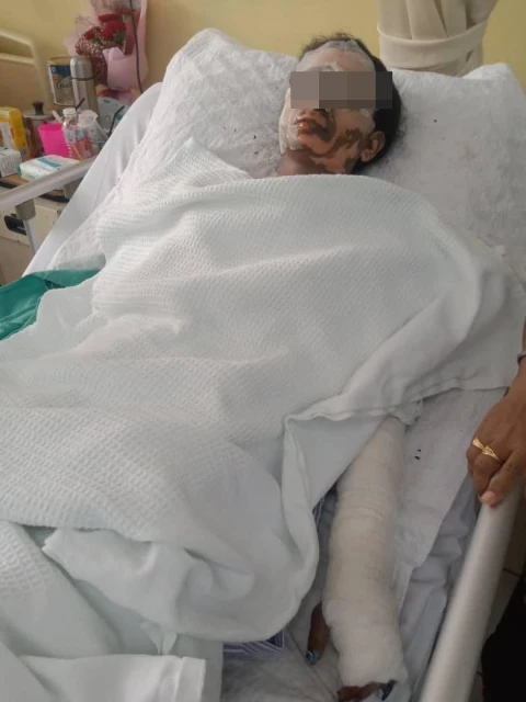 【高淵排屋煤氣爆炸案】 傷者：開門嗅到煤氣味　5人隨即被火氣震彈出門外