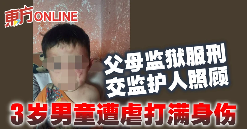 父母監獄服刑交監護人照顧　3歲男童遭虐打滿身傷