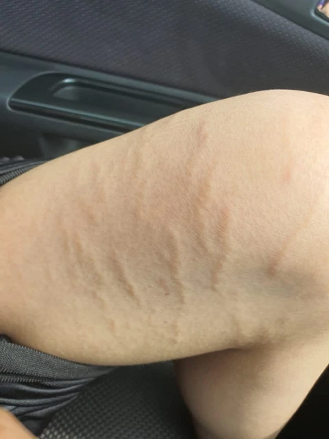 大馬1中學傳出霸凌案 中二生被迫接受門診治療