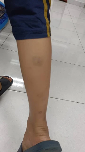 大馬1中學傳出霸凌案　中二生被迫接受門診治療