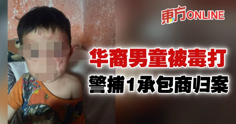 3歲男童遭毒打案　警逮捕一承包商歸案