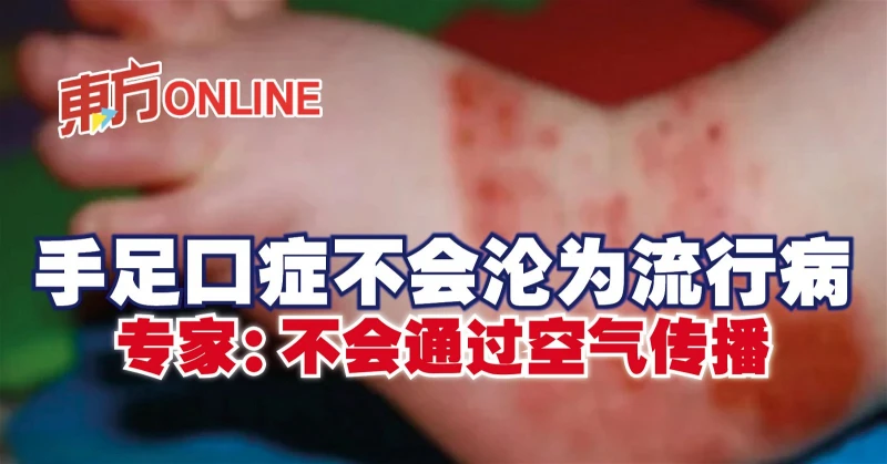 手足口症不會淪為流行病　專家：不會通過空氣傳播