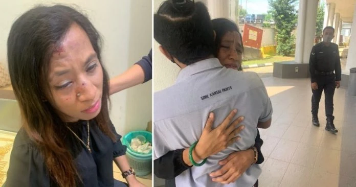 婦女超市門前遭瘋子拳打腳踢  頭部被攻擊20多次