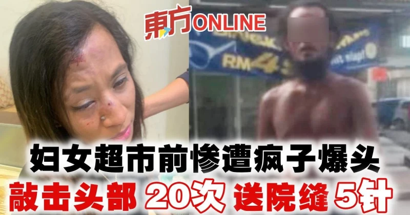 婦女超市前慘遭瘋子爆頭　敲擊頭部20次送院縫5針