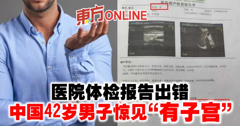 醫院體檢報告出錯　中國42歲男子驚見「有子宮」