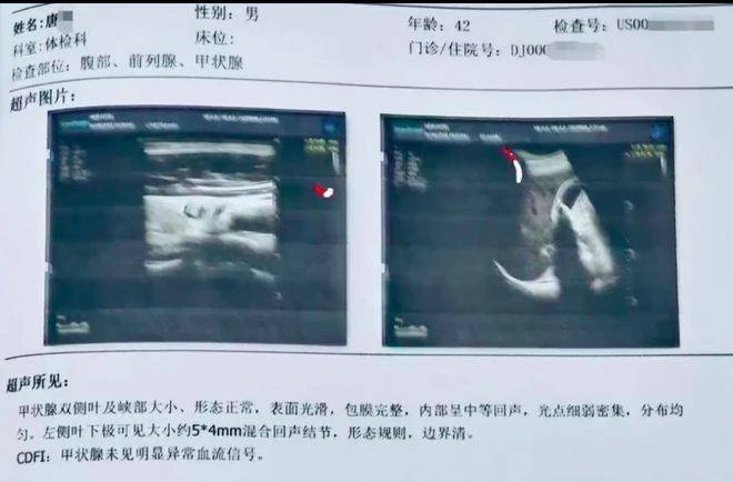 醫院體檢報告出錯　中國42歲男子驚見「有子宮」
