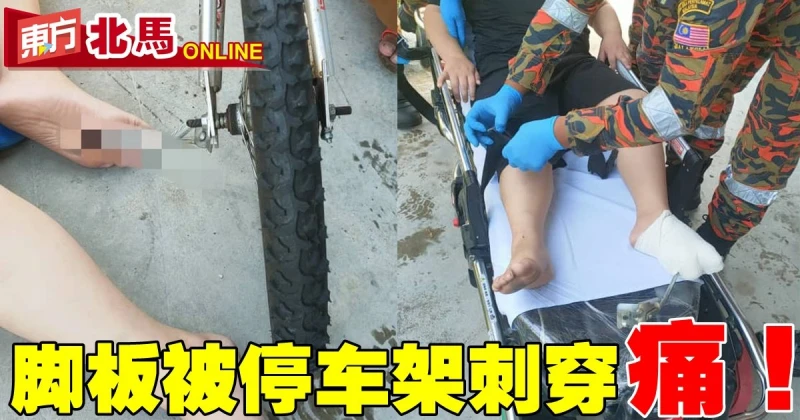 腳板被腳車停車架刺穿　男童緊急送院醫治