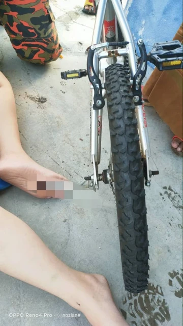 腳板被腳車停車架刺穿　男童緊急送院醫治