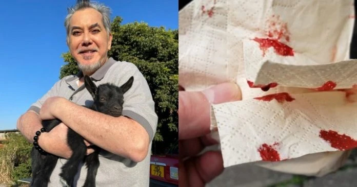 台灣做PCR被戳到噴鼻血　黃秋生：小事別吵架