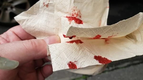 台灣做PCR被戳到噴鼻血　黃秋生：小事別吵架