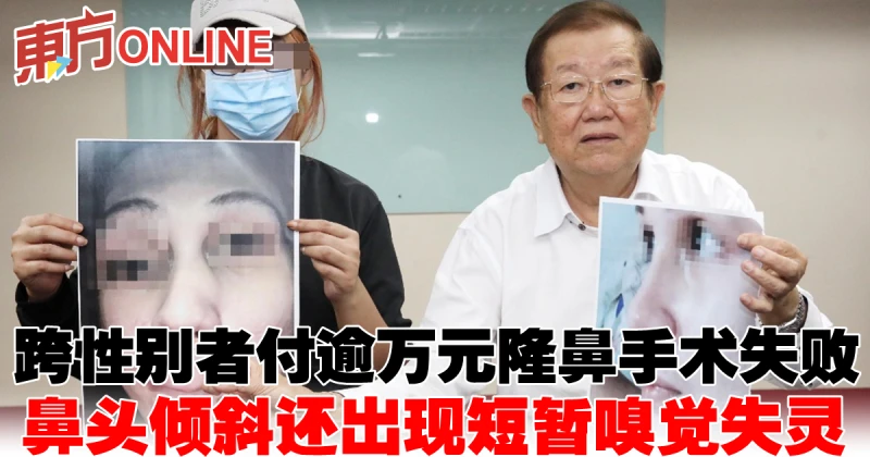 跨性別者付逾萬元軟骨隆鼻手術失敗　鼻頭傾斜還出現短暫嗅覺失靈