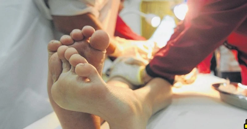 孩子割包皮後整個頭不見 媽媽怒提告獲賠310萬令吉