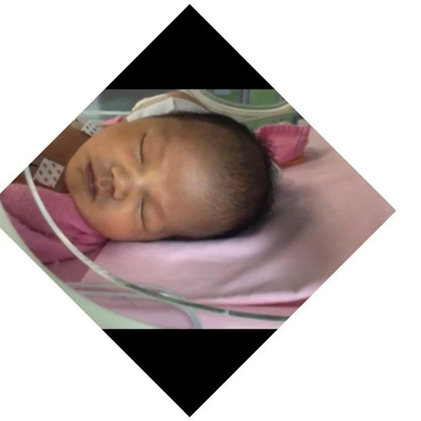 張致恆老婆早產誕第三胎　寶寶要插胃喉