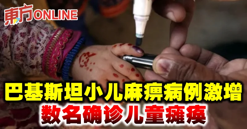 巴基斯坦小兒麻痹病例激增　數名確診兒童癱瘓