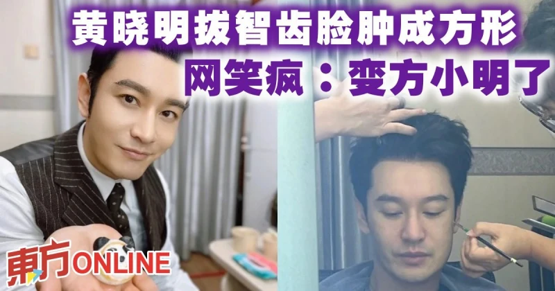 黃曉明拔智齒臉腫成方形　網笑瘋：變方小明了