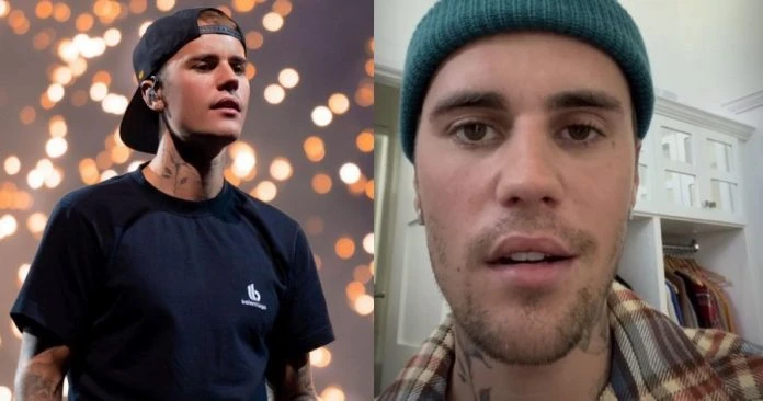 驚爆罹罕病右臉麻痹翻白眼　小賈斯汀臉歪嘴斜病容曝光