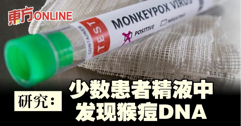 【猴痘疫情】研究：少數患者精液中發現病毒DNA