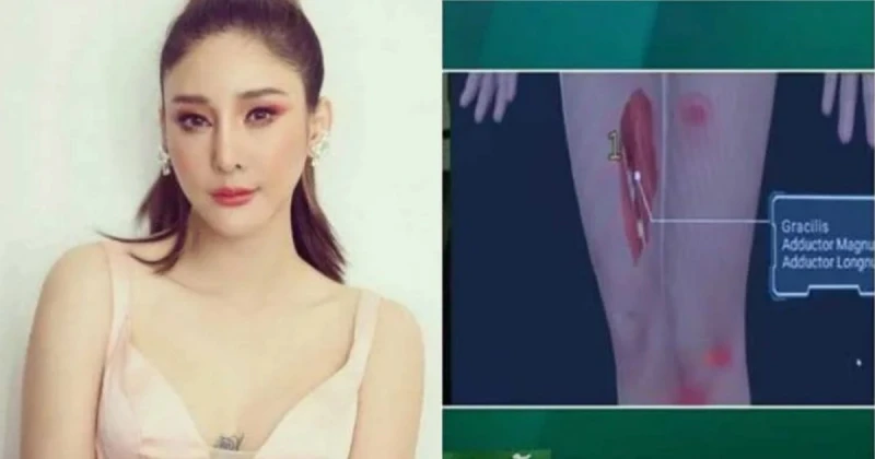 泰女星Tangmo溺斃「眼球凸出」　脖子驚見勒痕肺胃滿是泥巴