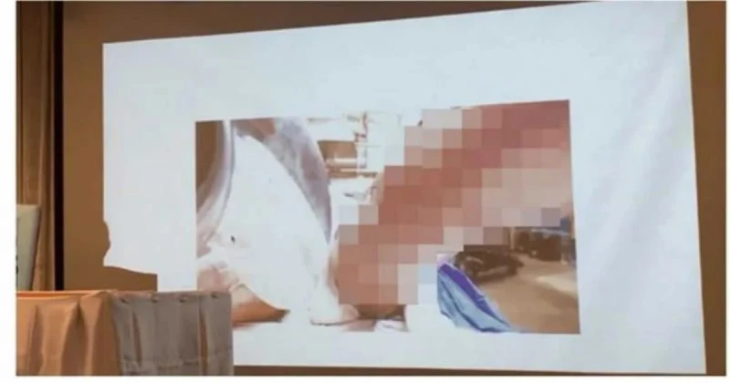 泰女星Tangmo溺斃「眼球凸出」　脖子驚見勒痕肺胃滿是泥巴