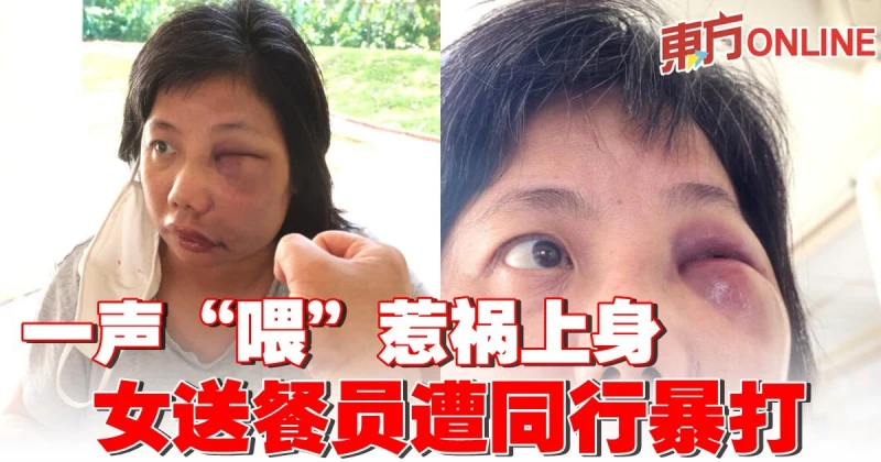 一聲「喂」惹禍上身　女送餐員遭同行暴打