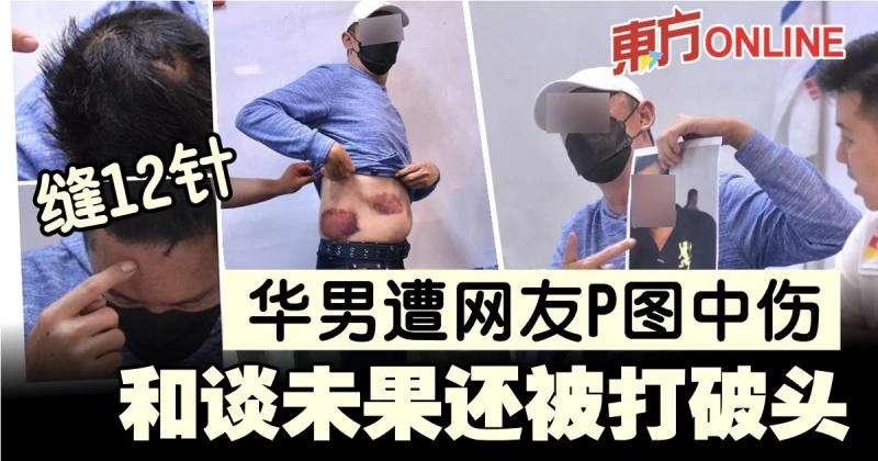 華男遭網友P圖中傷　和談未果還被打破頭縫12針