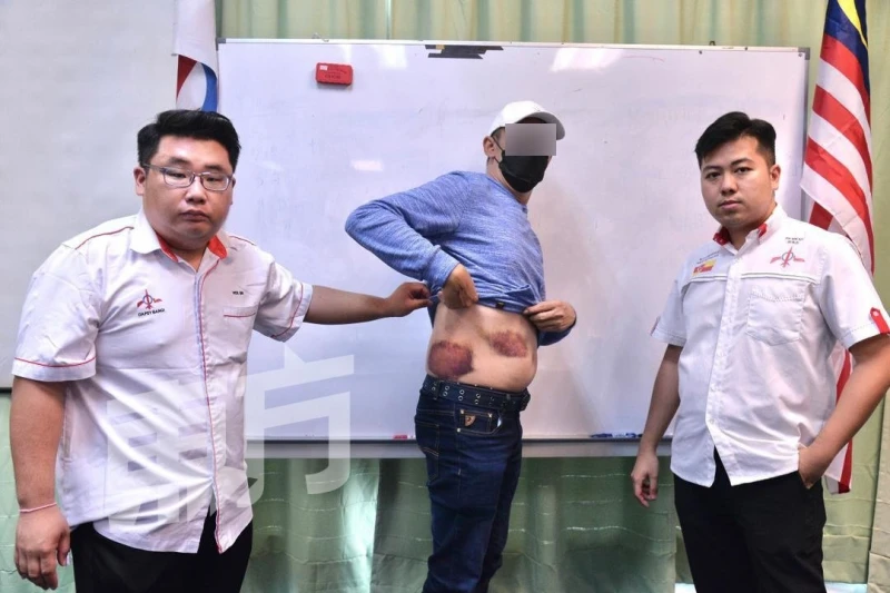 華男遭網友P圖中傷　和談未果還被打破頭縫12針