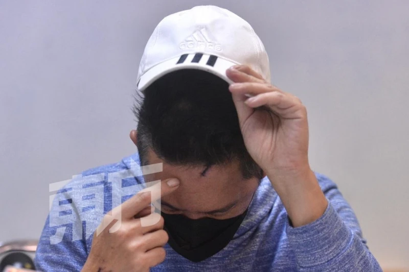 華男遭網友P圖中傷　和談未果還被打破頭縫12針