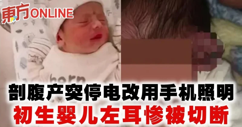 剖腹產突停電改用手機照明　初生嬰兒左耳慘被切斷