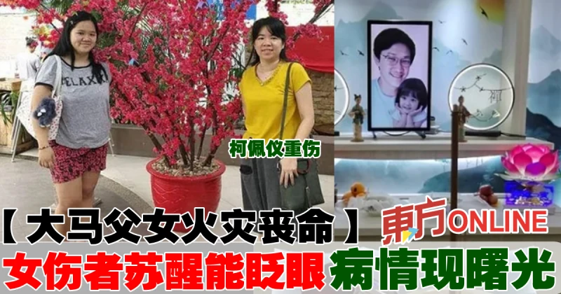 【大馬父女火災喪命】女傷者甦醒能眨眼　病情現曙光