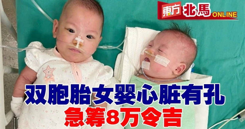 雙胞胎女嬰心臟有孔　急籌8萬醫費