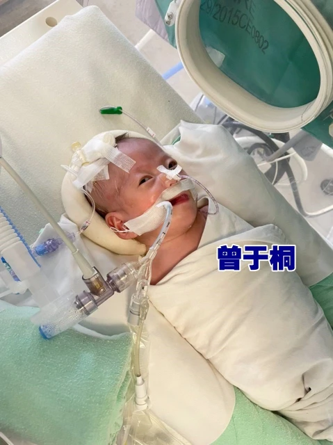 雙胞胎女嬰心臟有孔　急籌8萬醫費