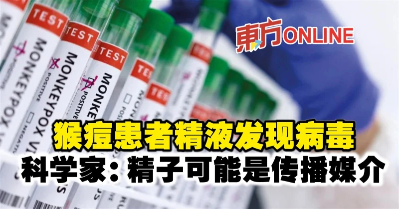 猴痘患者精液發現病毒　科學家：精子可能是傳播媒介