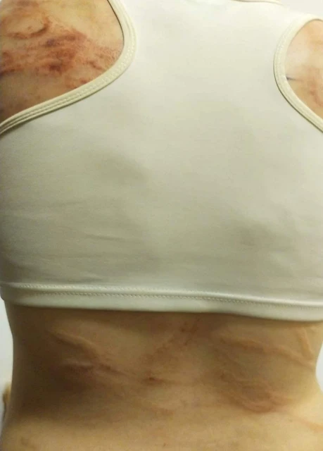 關水牢電棒體罰　「賣豬仔」受害者勸勿輕信友人介紹高薪工作