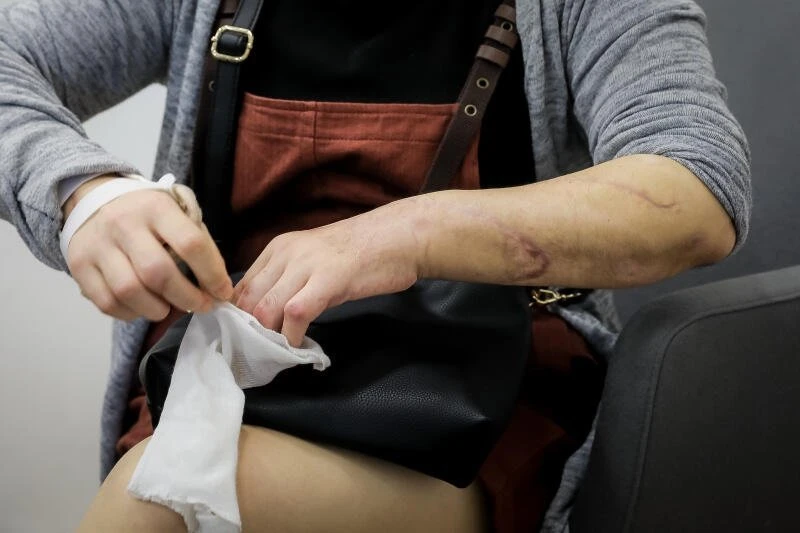 【新加坡美芝路砍人案】女傷者：為了一對兒女　一定要活下去