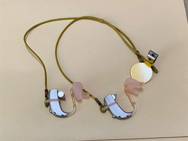 7歲女童雙耳重聽盼走出無聲世界　尚缺12.8萬令吉人造耳蝸費