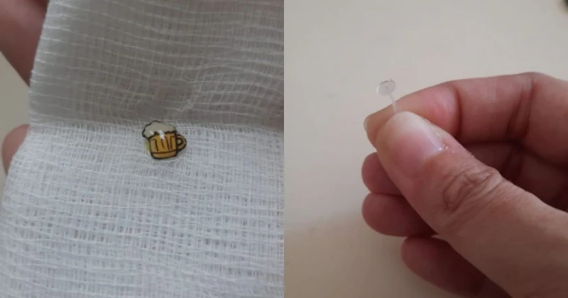 女子耳朵劇痛求醫　驚覺耳環掉入耳朵內