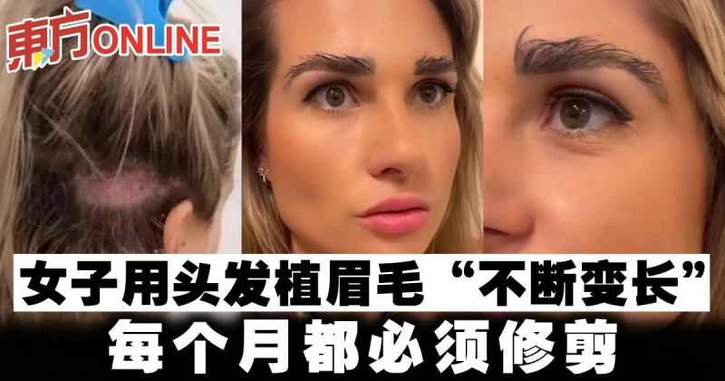 女子用頭髮植眉毛「不斷變長」　每個月都必須修剪