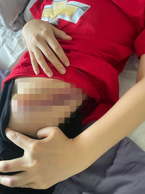 華裔情侶遭逆行四輪車猛撞重傷　肇禍司機今午到警局自首被捕