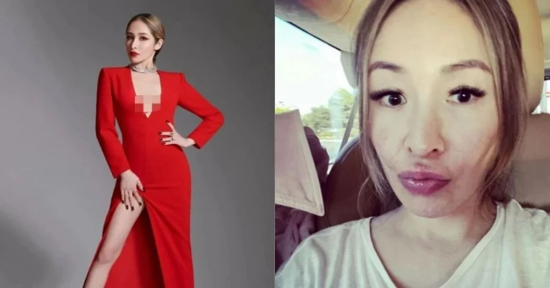 蕭亞軒曬素顏照曝臉上傷疤 網力挺:依然是女神!