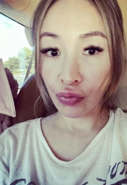 蕭亞軒曬素顏照曝臉上傷疤　網力挺：依然是女神！