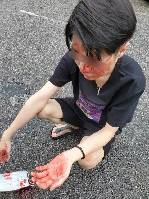 轎車與摩哆小擦撞 華青道歉反遭頭盔砸至骨裂