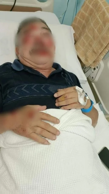 老翁車禍受傷仍堅持送餐去老人院 盡責精神感動院內所有人