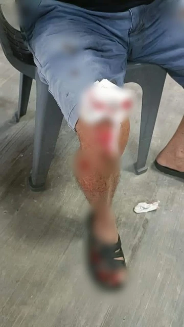 老翁車禍受傷仍堅持送餐去老人院　盡責精神感動院內所有人