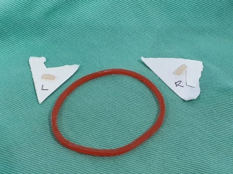 女友開心宣布懷孕　男崩潰：已結紮10年