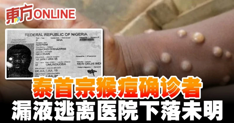 泰首宗猴痘確診者　漏液逃離醫院下落未明