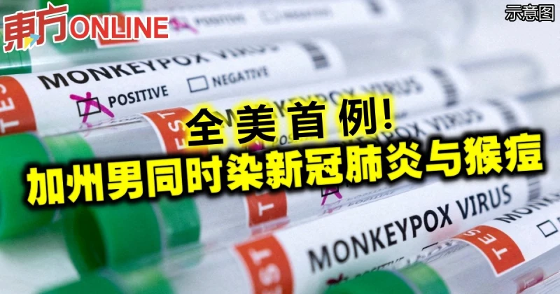 全美首例！加州男同時染新冠肺炎與猴痘